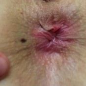 extreme closeup asshole blue dream