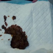 fast diarrhea hd hotdirtyivone