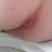 heidi foxx tiny turds