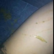 cleopatrax19 i have a lot of diarrhea and i can`t stand to explode in the shower !!!