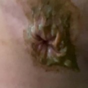 painful diarrhea hd The fart babes