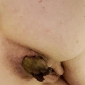 Freckledred Slow Motion Replay Poop