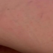 Nicolettebloom Poop Diary Day 4