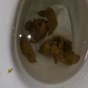 Kittyskatt Huge Diarrhea Attack At Vanilla Shoot Kitty Klitt