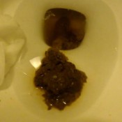 Dirty Lesbians Caught Shitting While On The Phonephone12272020